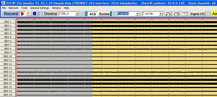 Data recording is started