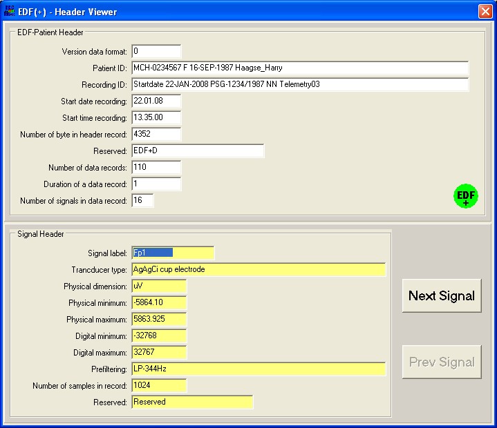 EDF-Header viewer channel 1