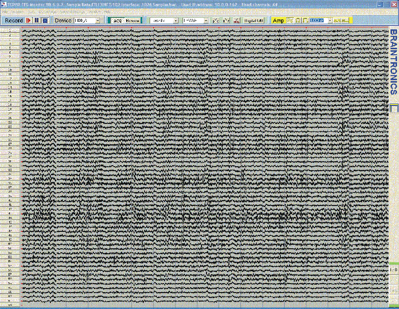 EEG-Monitor screen shot